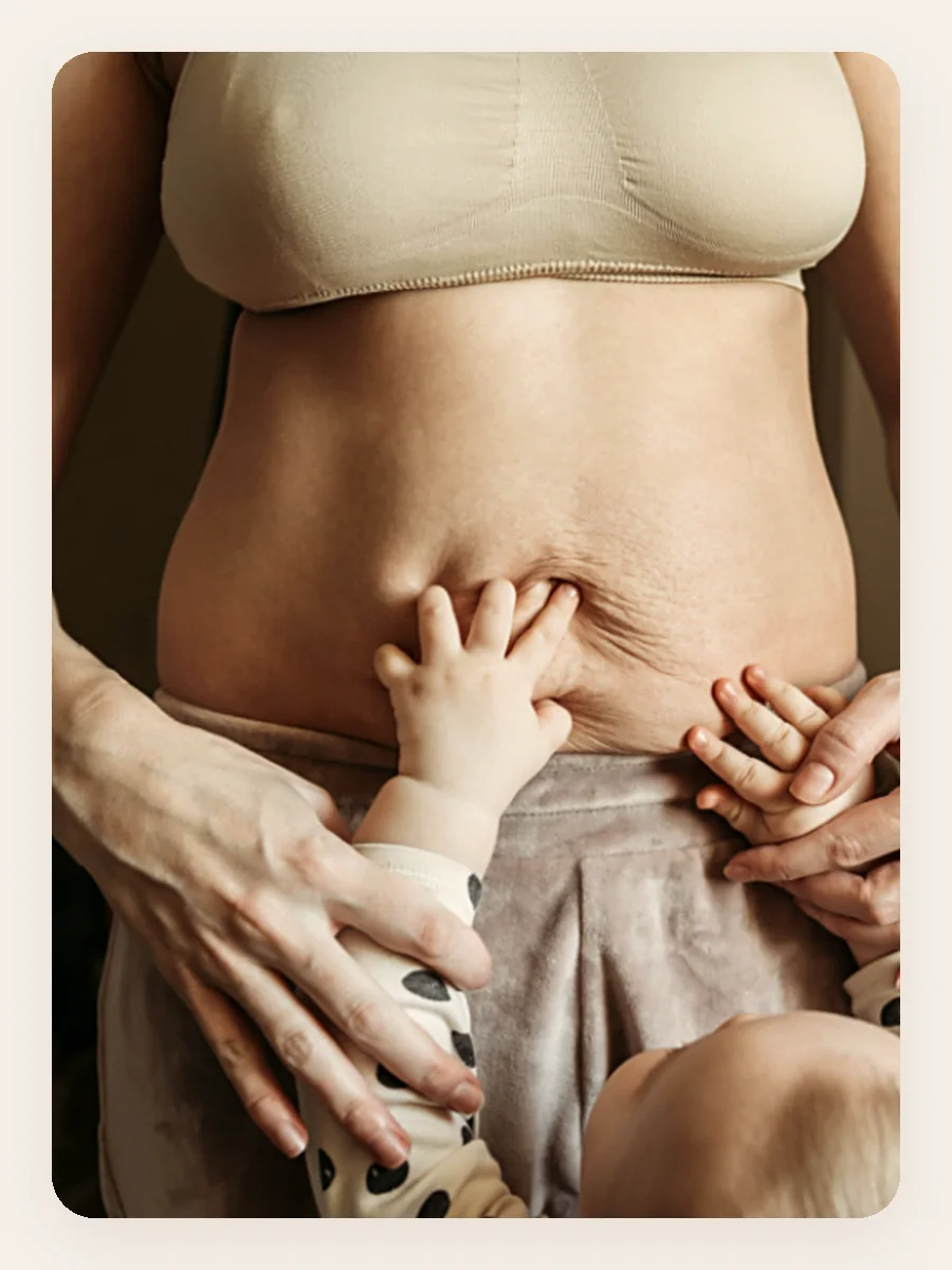 A mother holding her baby, with the soft postpartum tummy Mum21 helps rebuild