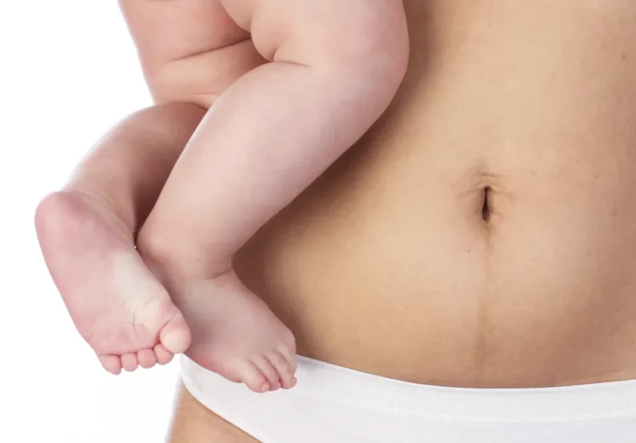 A mother holding her baby, postpartum belly visible, unretouched